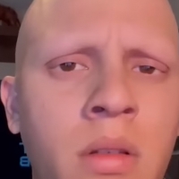 bald headed guy eyebrows