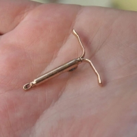 trinket iud